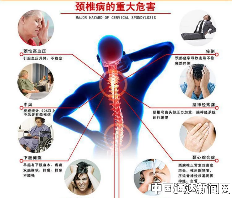 颈椎病的症状表现