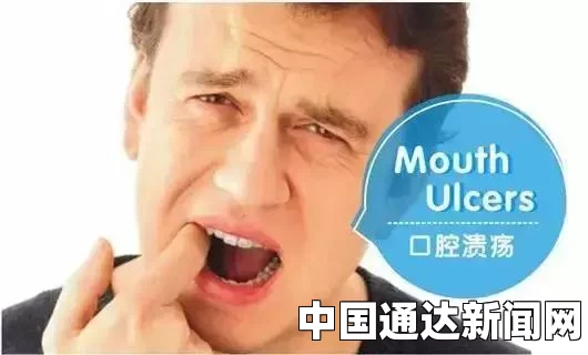 舌头溃疡是一种常见的口腔疾病，它通常表现为舌头上出现疼痛的溃疡，给患者带来极大的不便和痛苦。本文将详细介绍舌头溃疡的成因、症状、预防和治疗方法，并在结尾处进行1-3个问答环节。