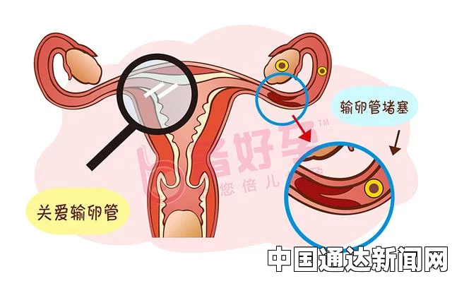 输卵管堵塞的10个征兆