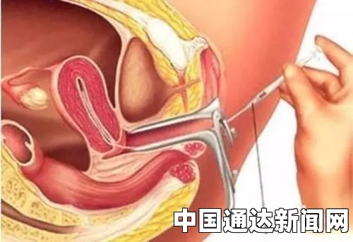 肠鸣，被忽视的生理现象，揭示肠道健康的重要标志